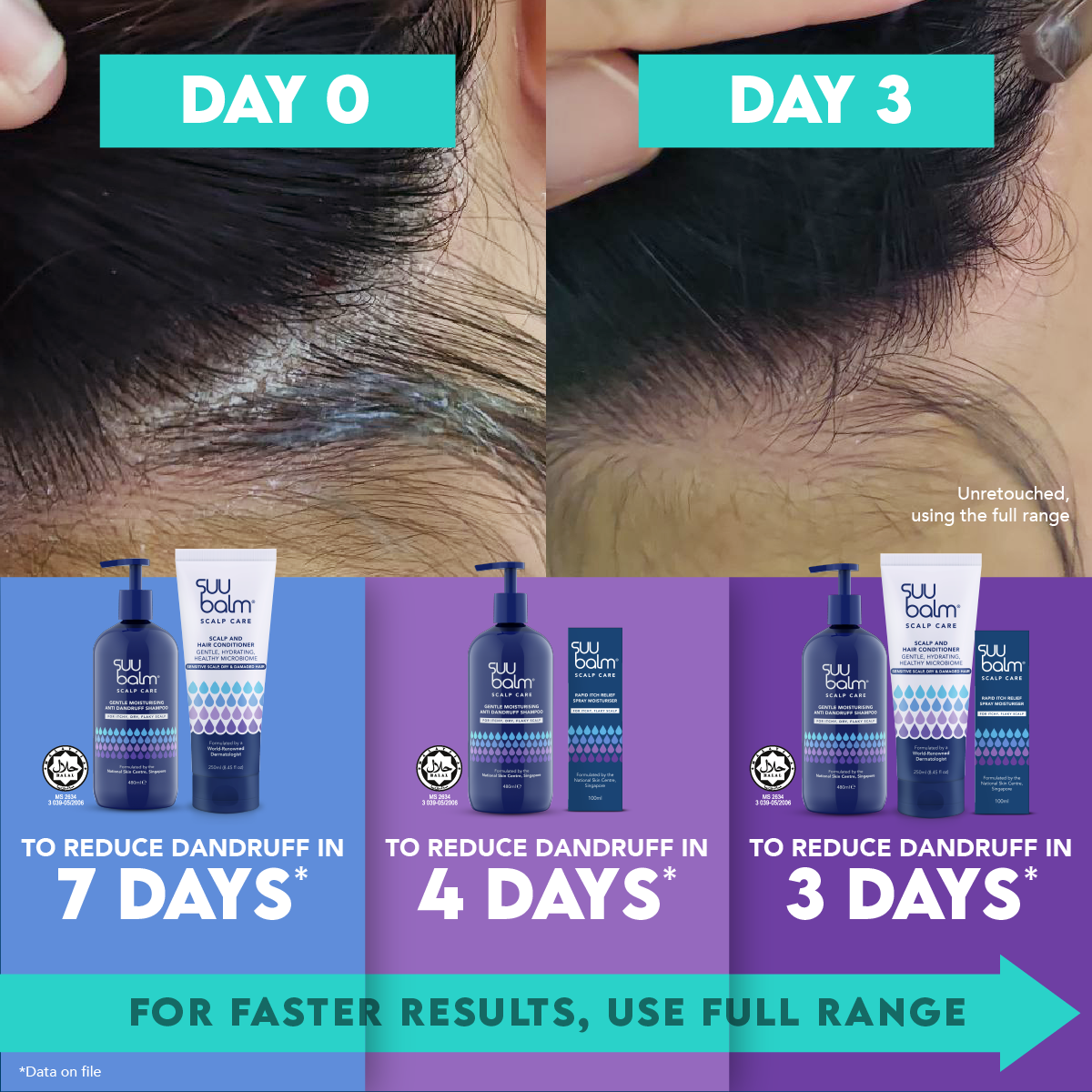 Suu Balm Scalp & Hair Conditioner