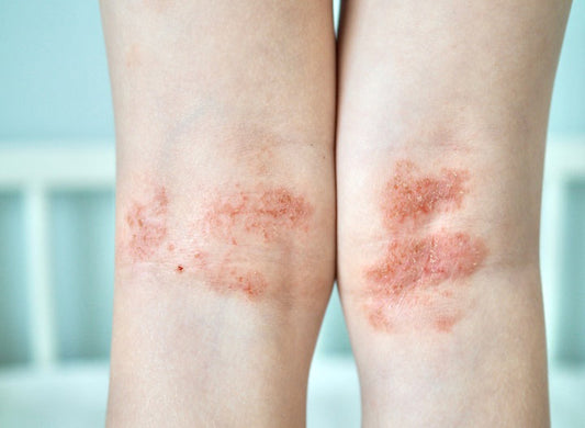 提示 Penjagaan Kulit Sensitif：Dari Pencuci Muka hingga Mandian Bayi