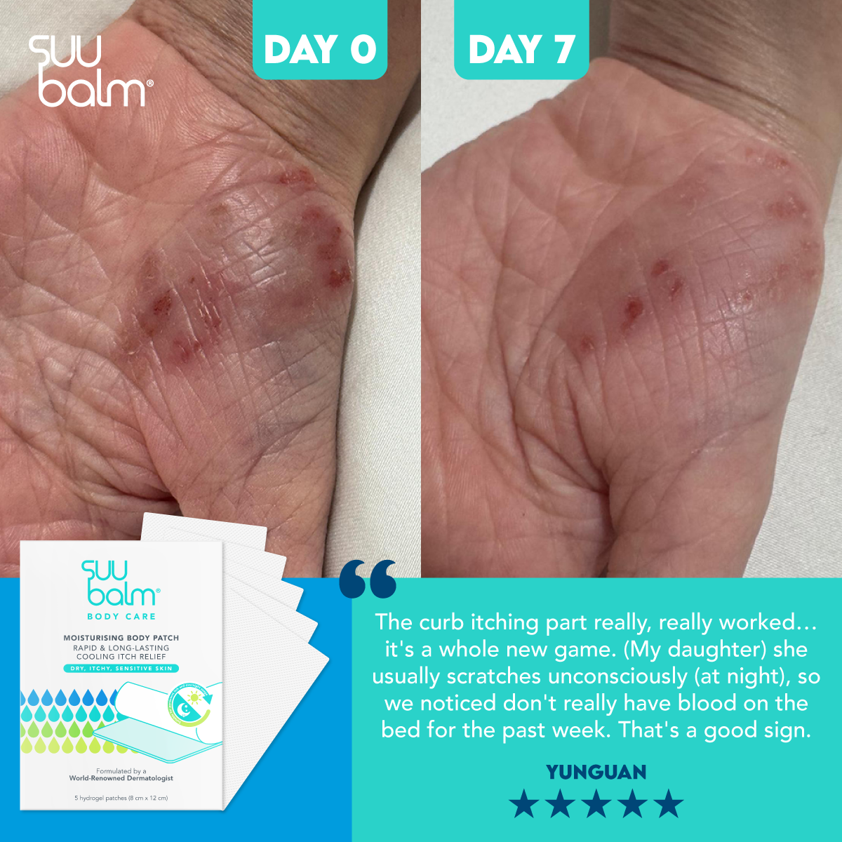 Suu Balm® Moisturising Cooling Body Patch